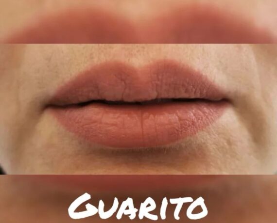 Foto1