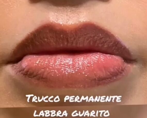 Foto5