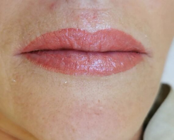 Foto9