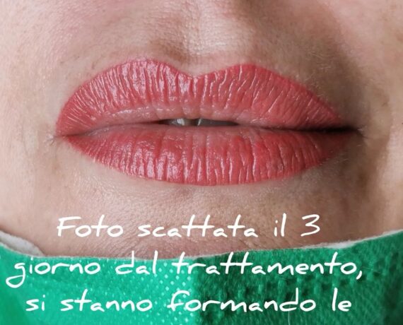 Foto12